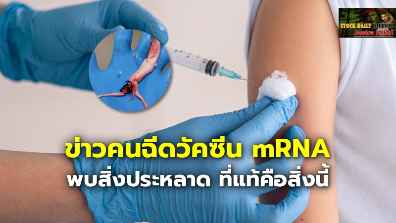 ข่าวคนฉีดวัคซีน mRNA พบสิ่งประหลาด ที่แท้คือสิ่งนี้